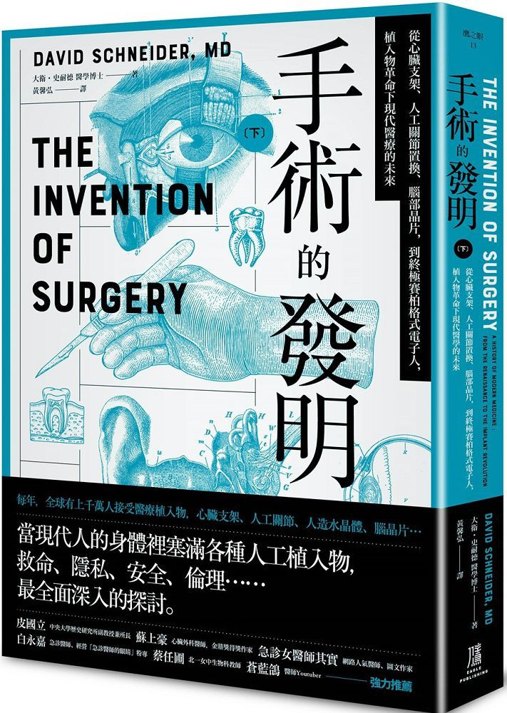 手術的發明（下）從心臟支架、人工關節置換、腦部晶片，到終極賽柏格式電子人，植入物革命下現代醫療的未來