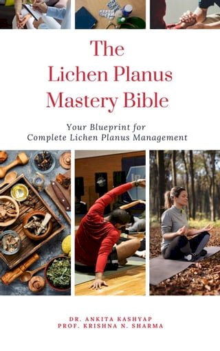 The Lichen Planus Mastery Bible: Your Blueprint for Complete Lichen Planus Management(Kobo/電子書)