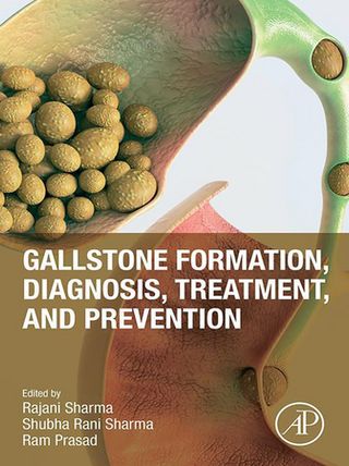 Gallstone Formation, Diagnosis, Treatment and Prevention(Kobo/電子書)