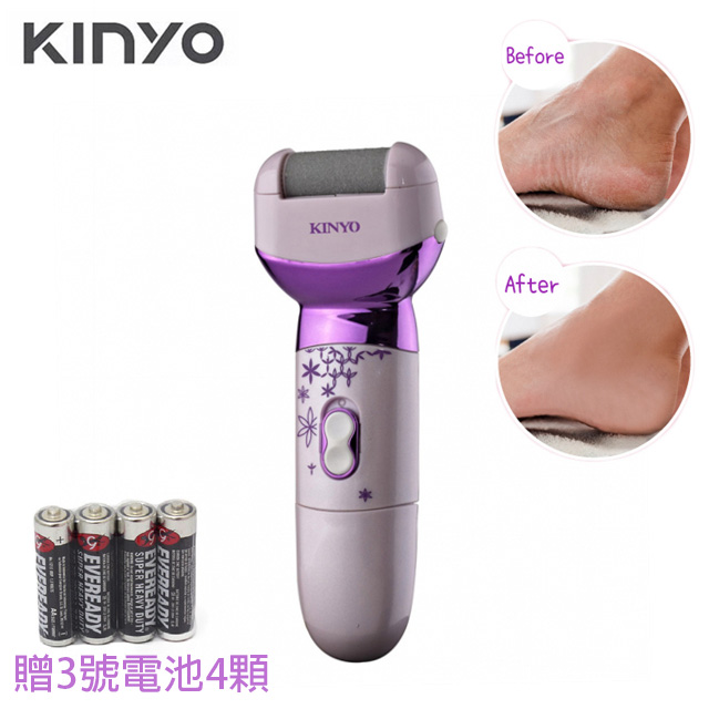 KINYO 便攜電池式去角質美足機 去硬皮磨腳機 美足清潔機 去腳皮機